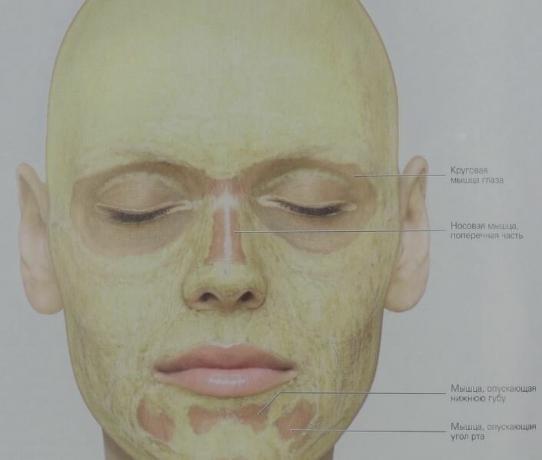 È così che il grasso sottocutaneo è distribuito nella nostra faccia (giallo). Nei muscoli circolari dello strato occhi del tessuto connettivo contiene quasi nessun grasso