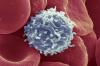 Gli scienziati hanno trovato un modo, causando le cellule T per cominciare a combattere il cancro