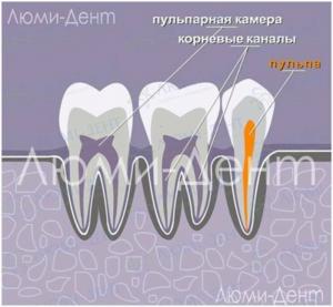 Come trovare e curare i canali dentali in Lumident