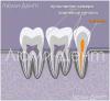 Come trovare e curare i canali dentali in Lumident