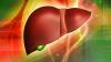 10 regole di base di fegato sano