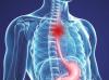 Cancro esofageo: i primi segnali di cui non può essere ignorato