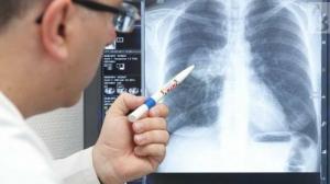 Il medico confronta l'esposizione alle radiazioni con la TC dei polmoni con le radiazioni a Hiroshima
