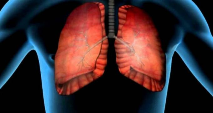 Il cancro al polmone