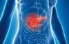 I sintomi del cancro del pancreas