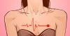 5 più strani sintomi di attacco cardiaco nelle donne