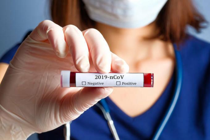 Un infettivista ha previsto il picco di incidenza del coronavirus in Ucraina