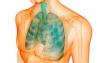 Malattia polmonare che si insinua inosservato