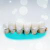 Denti splintaggio popolari: quanto efficace?