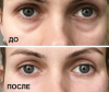 Una conveniente maschera 40 rubli correzione scanalature nasolacrimali: il risultato dopo la prima applicazione. Estetista non è più necessario