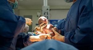 Come prepararsi per un parto cesareo