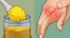 Come sbarazzarsi del dolore alle articolazioni delle mani