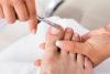 2 modi per tagliare le unghie dei piedi ispessite